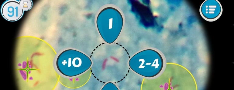 TuberSpot videojuego para diagnosticar Tuberculosis